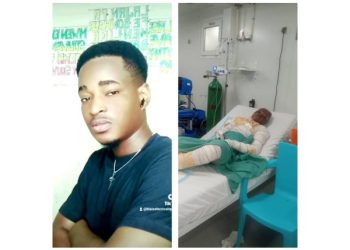 Drame à Delmas : gravement brûlé, un jeune homme perd sa mère, sa femme et sa fillette dans un incendie tragique — Un appel urgent à la solidarité