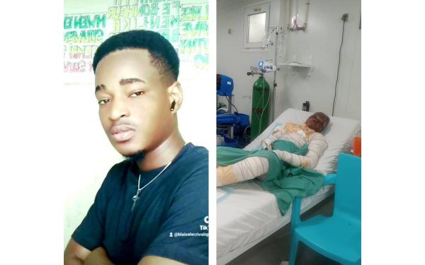 Drame à Delmas : gravement brûlé, un jeune homme perd sa mère, sa femme et sa fillette dans un incendie tragique — Un appel urgent à la solidarité